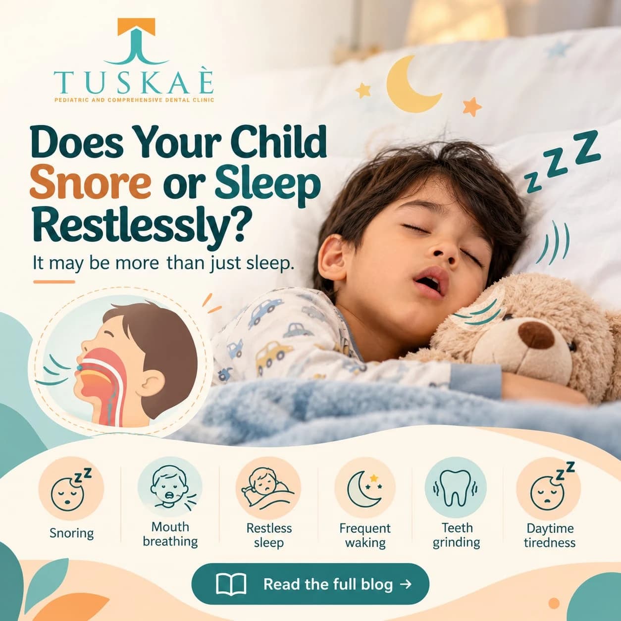 My Child Is Snoring — What Should I Do? (Causes, Warning Signs & Next Steps)