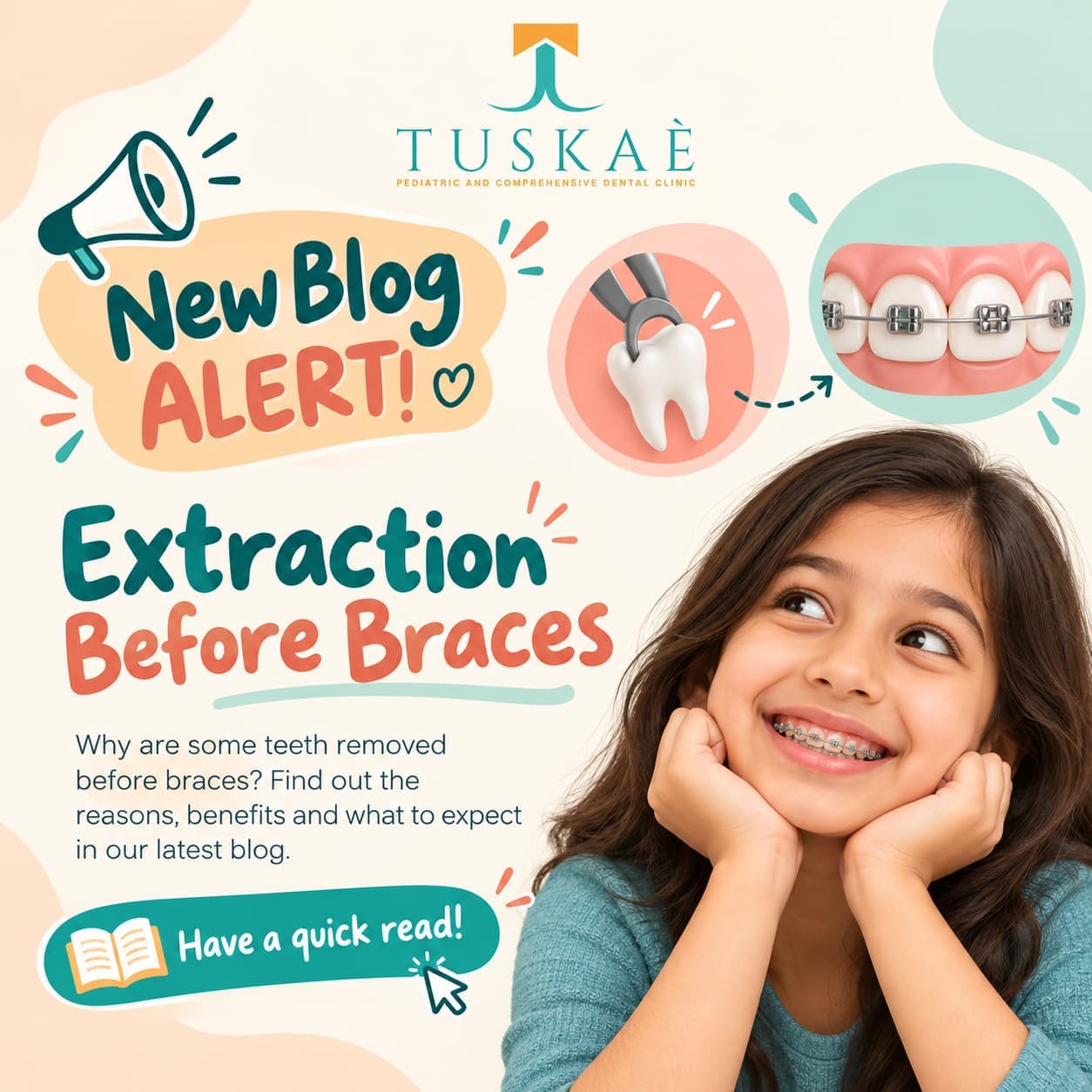 Do I Need Teeth Removed Before Braces? Do Teeth Always Need to Be Extracted for Orthodontic Treatment?