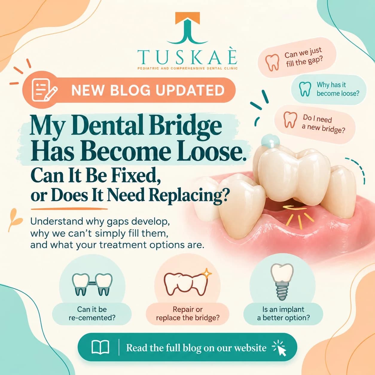 My Dental Bridge Has Become Loose. Can It Be Fixed, or Does It Need Replacing?