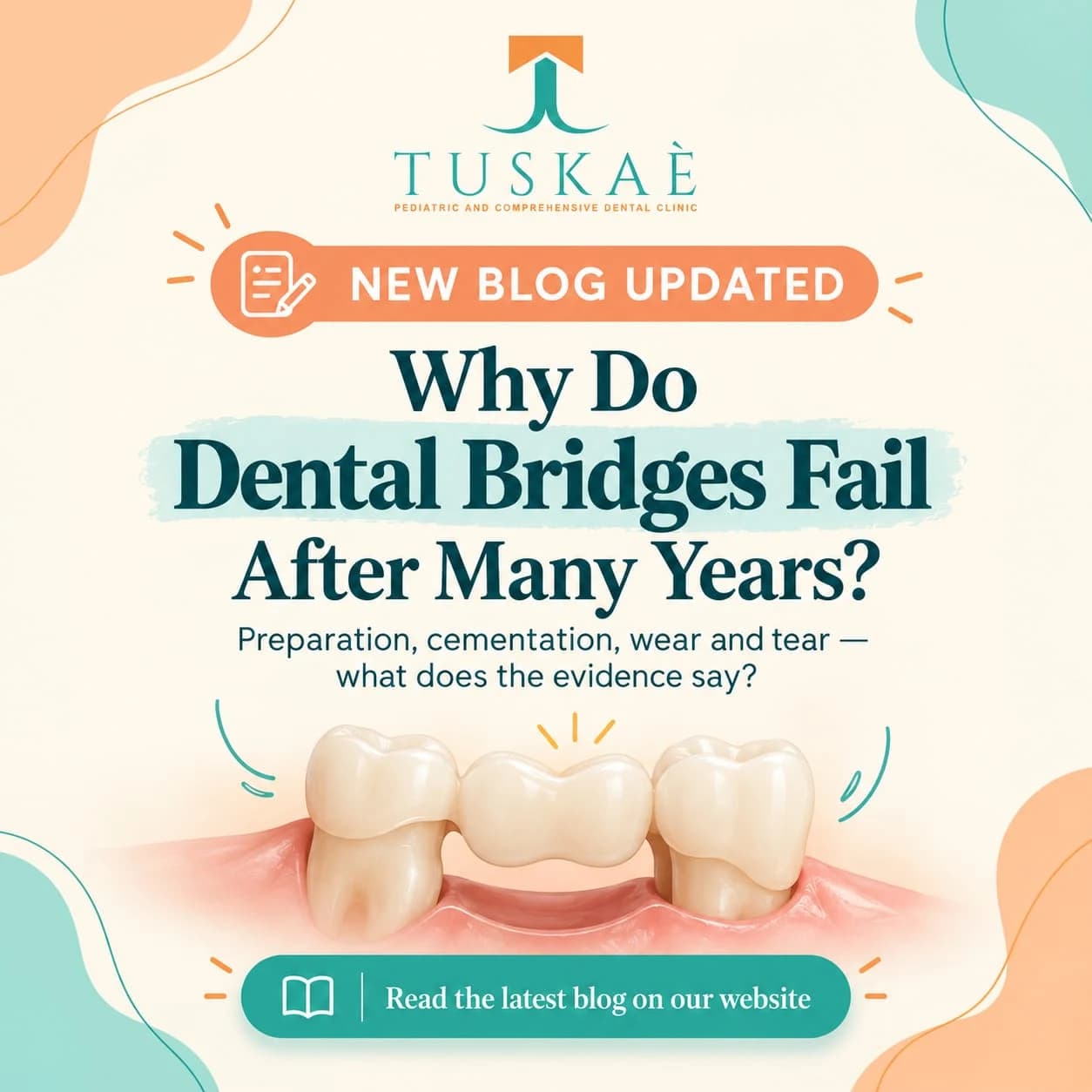 Why Do Dental Bridges Fail After Many Years?